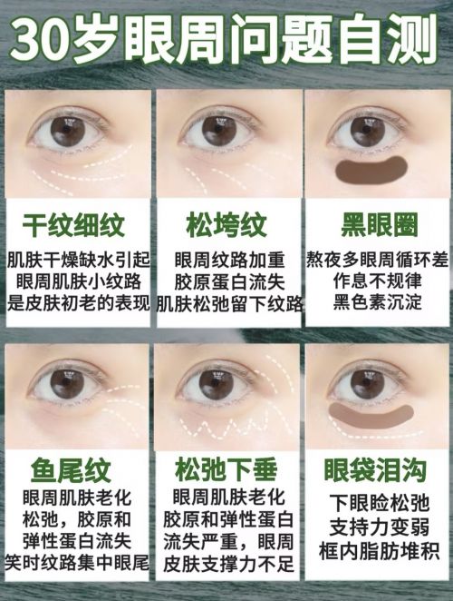 效果好？眼周问题自测攻略5大实力派眼霜AG旗舰厅app2025什么眼霜去皱