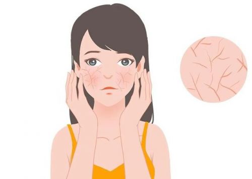 霜：修护敏感肌肤重塑健康屏障AG旗舰厅第二代薇诺娜特护